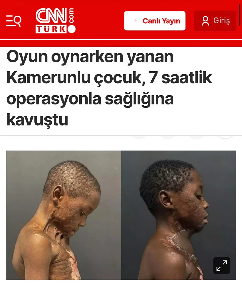 dr burak özkan - CNN