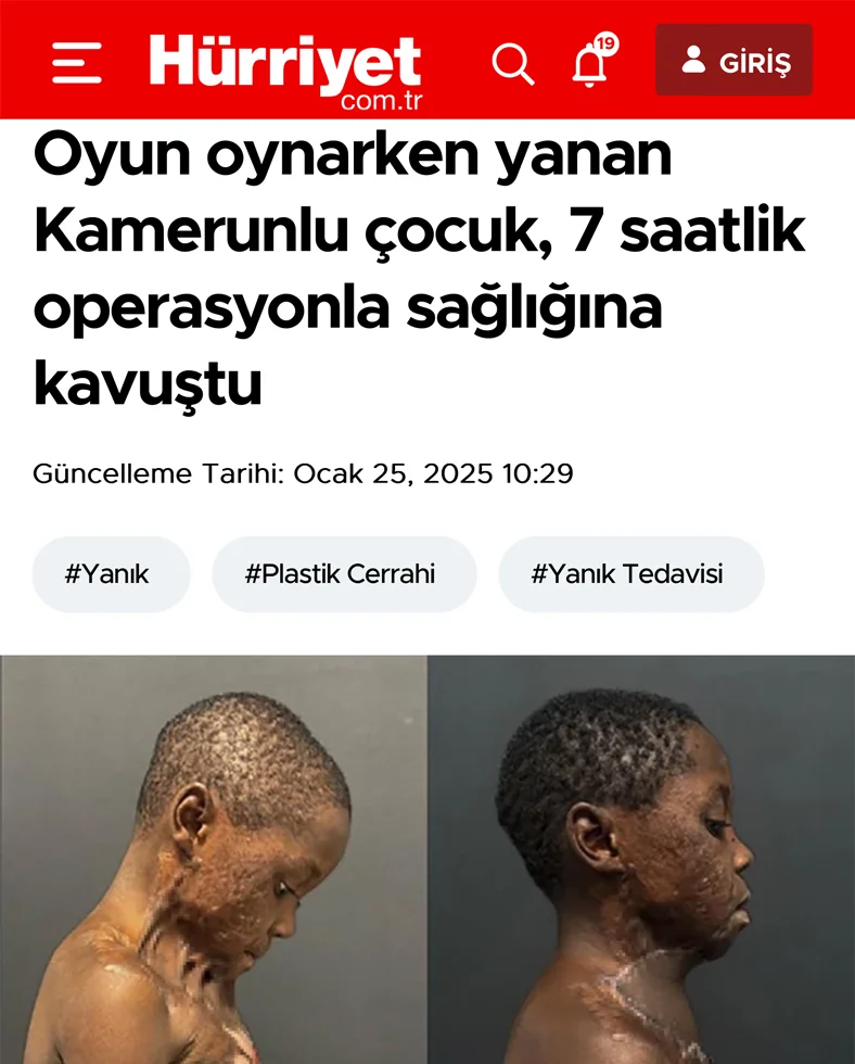 dr burak özkan - hürriyet