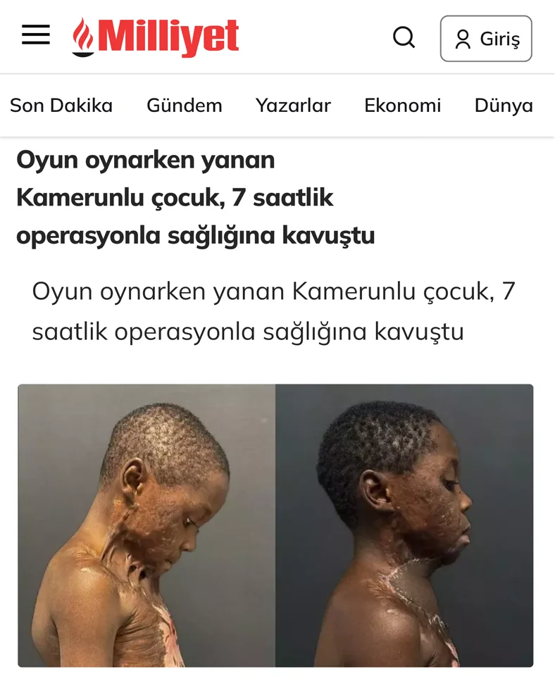 dr burak özkan - milliyet